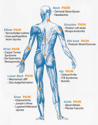 Sports acupuncture diagram highlighting treatment points for pain relief in various body areas such as neck, shoulder, back, and knee