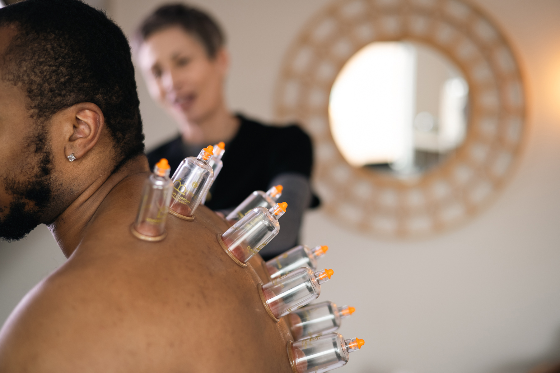 Man receiving body cupping therapy on his back