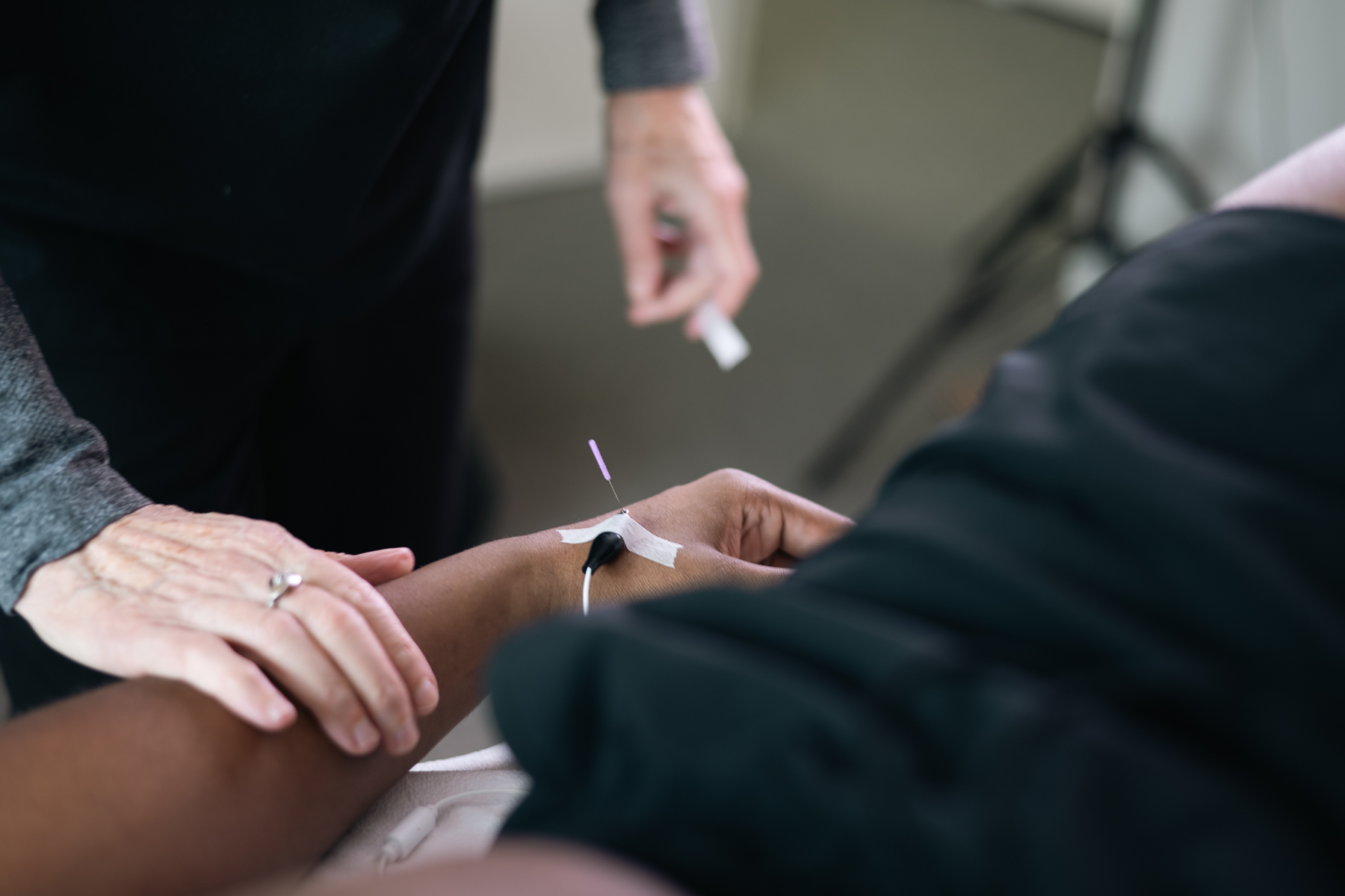 Close-up of electroacupuncture on a person's wrist with a practitioner nearby