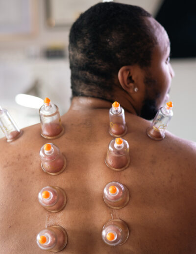 Bodycupping therapy session with multiple suction cups applied to the back for muscle relief and improved circulation