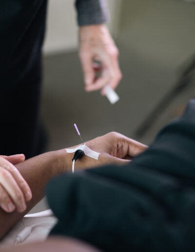 Close-up of electroacupuncture on a person's wrist with a practitioner nearby