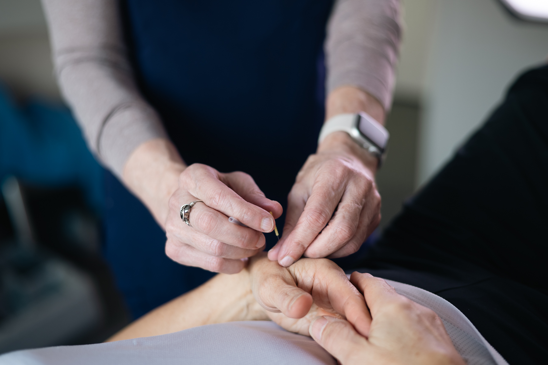 An acupuncture needle into a patient's hand as part of therapy for sports injuries