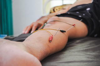 Electroacupuncture knee treatment - Jeanne Meck Electroacupuncture treatment on patient's knee at The Zen Point in Bethesda MD
